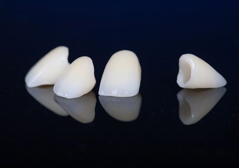 Dental Crowns