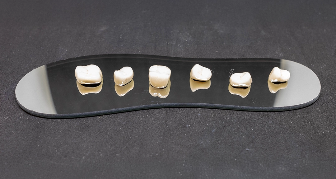 Rock-solid second chances with dental crowns