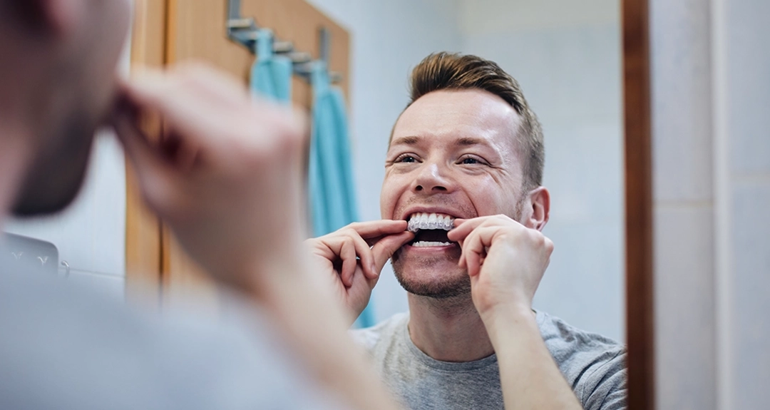Do take-home whitening kits really get the job done