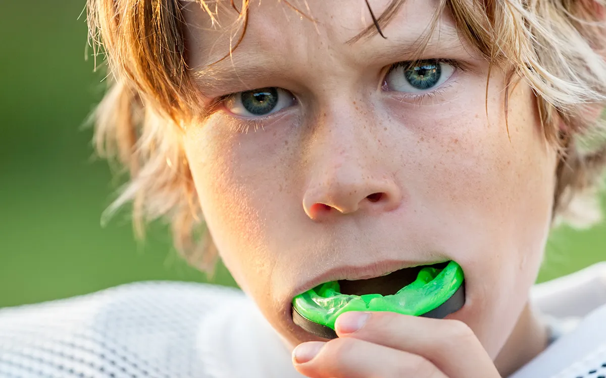 custom mouthguards
